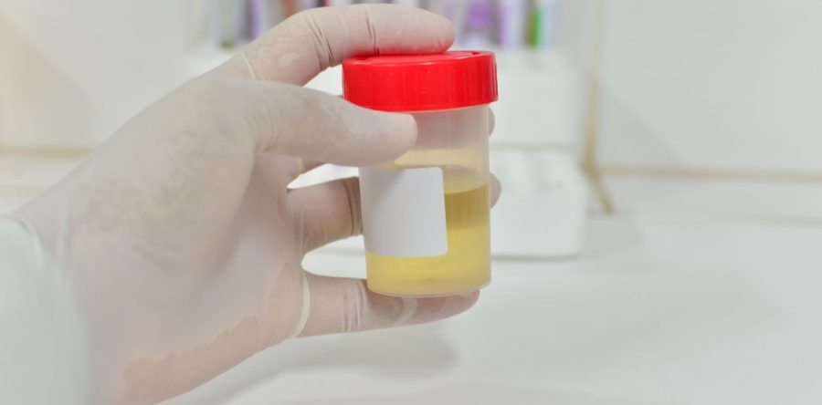 Can You Have Blood in Your Urine and Not Know It?